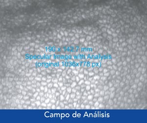 Campo de análisis del CellChek D de Konan, microscopio especular de imagen para banco de ojos